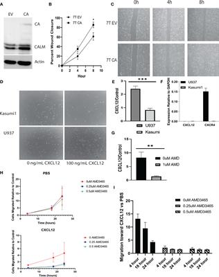 CXCR4 Mediates Enhanced Cell Migration in CALM-AF10 Leukemia